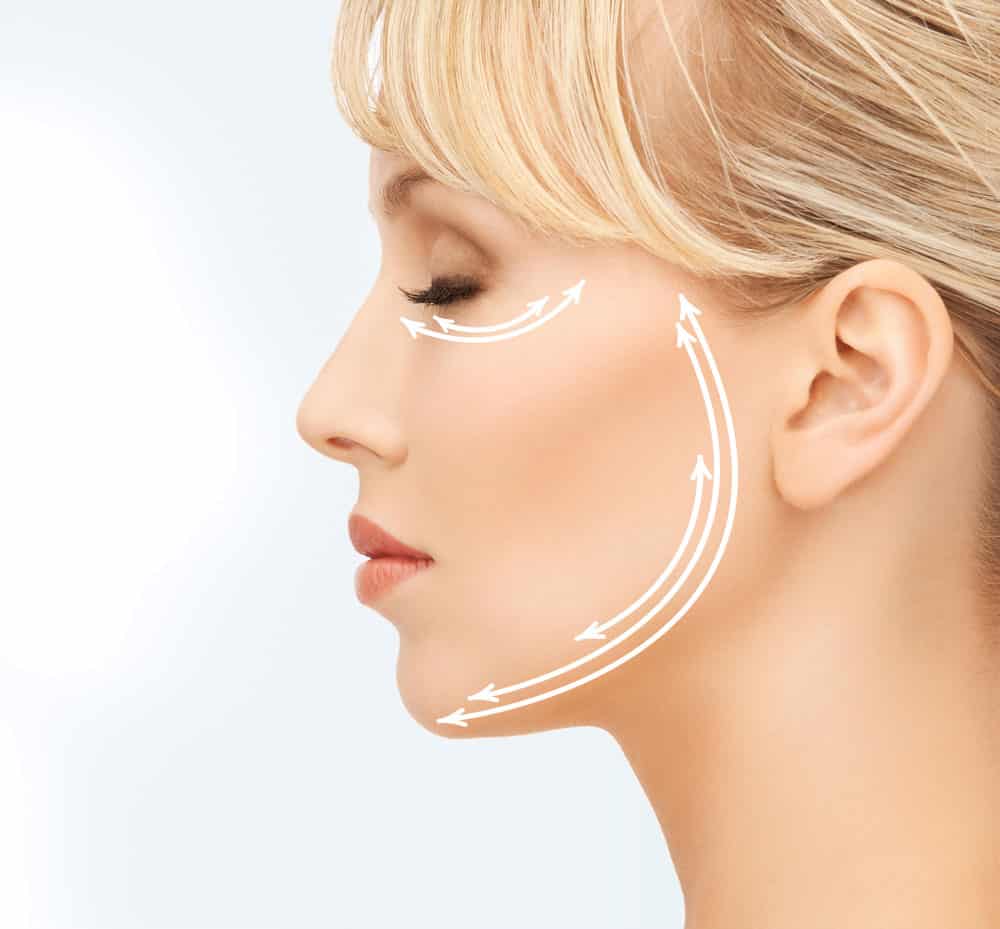 Kompositorische Ästhetik - Fadenlifting & Needling 2
