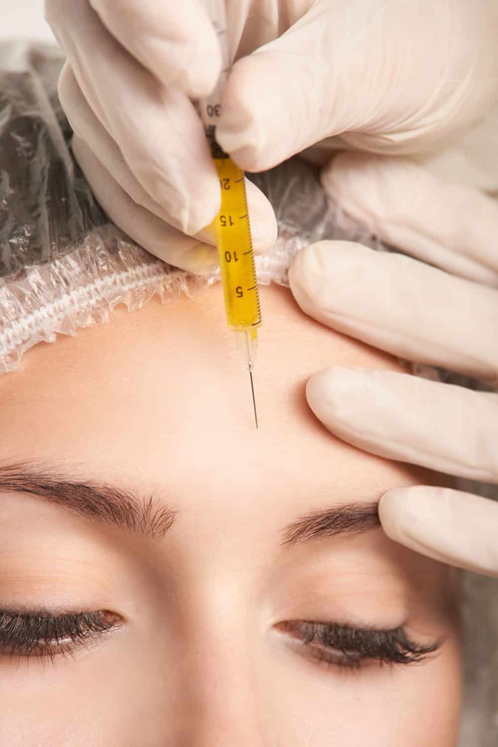 Kompositorische Ästhetik - Mesotherapie mit PRP 1