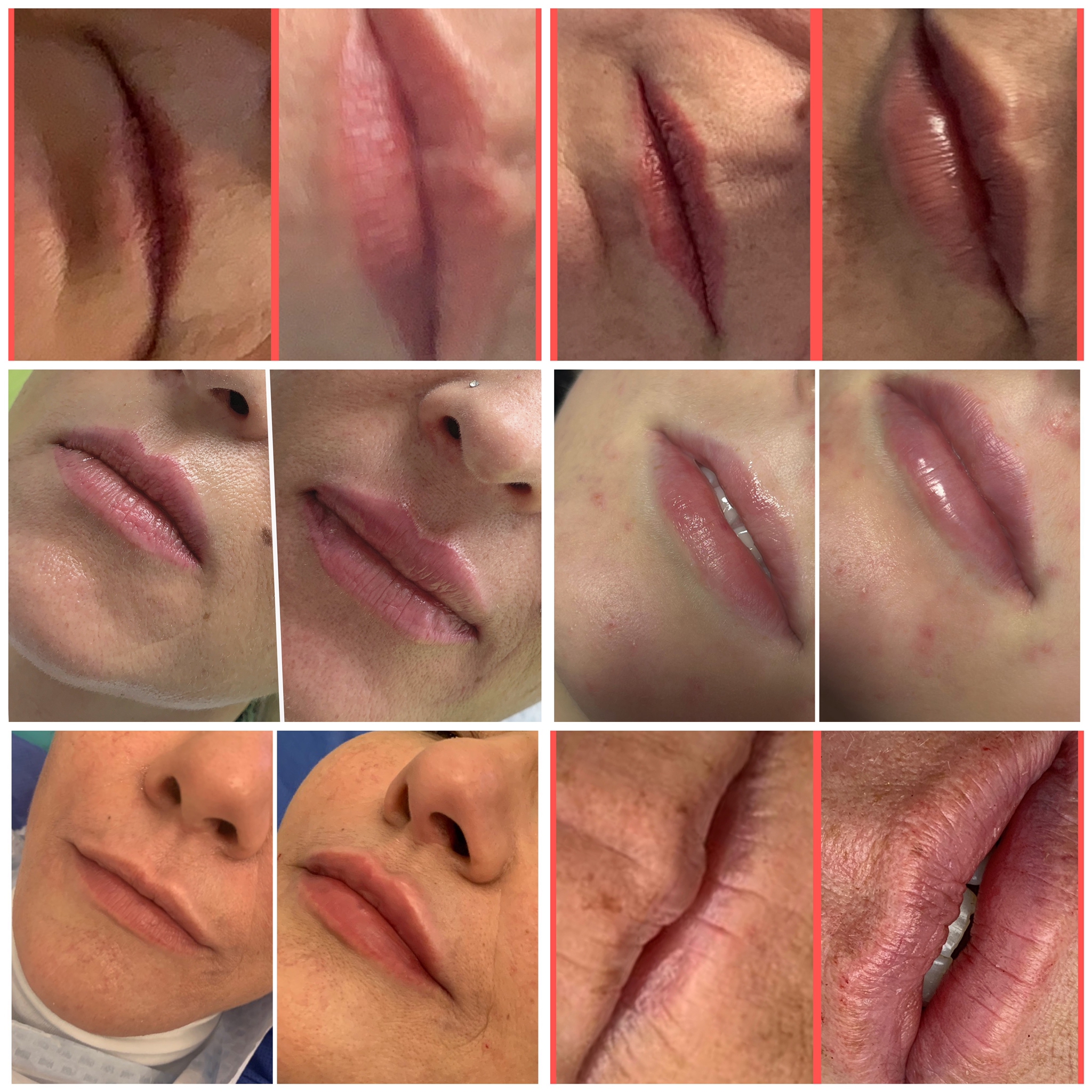 Lippen-Medirasday